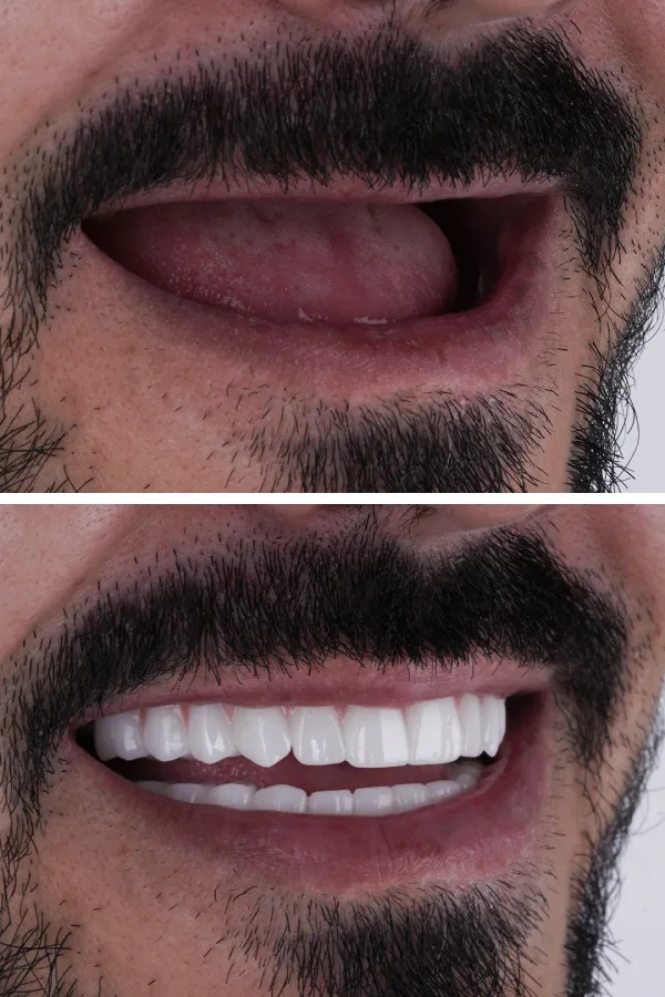 Ömer İstanbul case