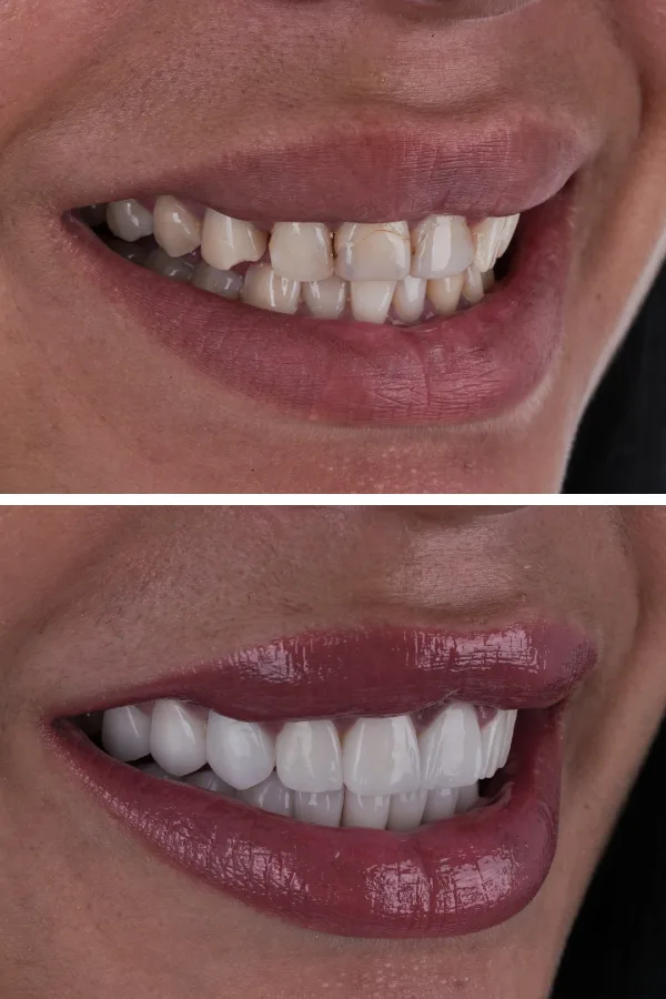 Ömer İstanbul case