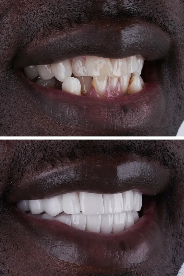 Ömer İstanbul case