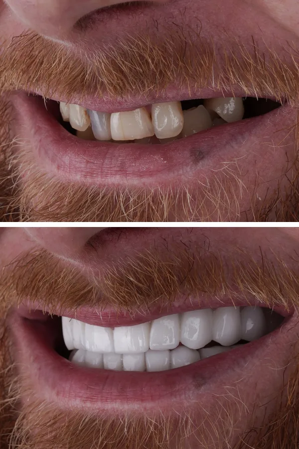 Ömer İstanbul case