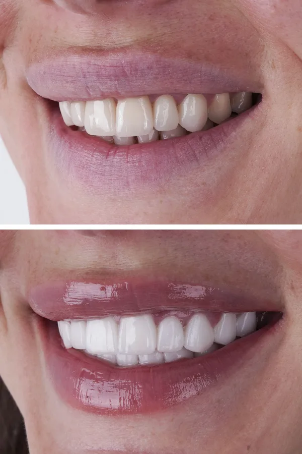 Ömer İstanbul case