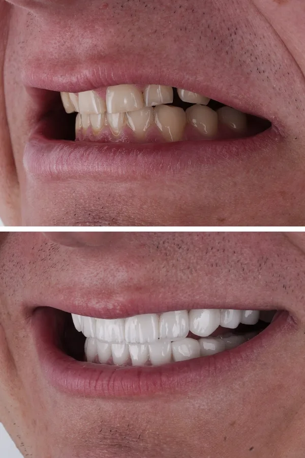 Ömer İstanbul case