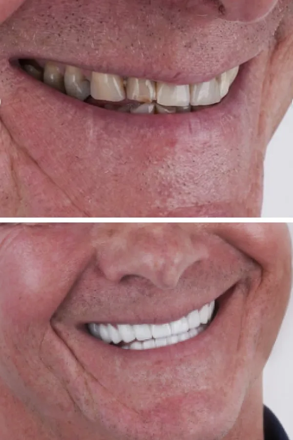 Ömer İstanbul case