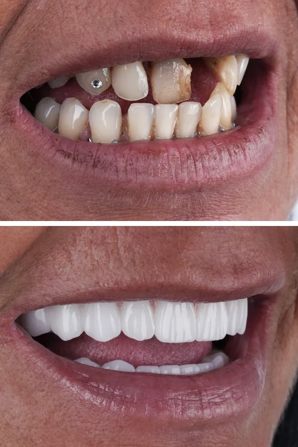 Ömer İstanbul case