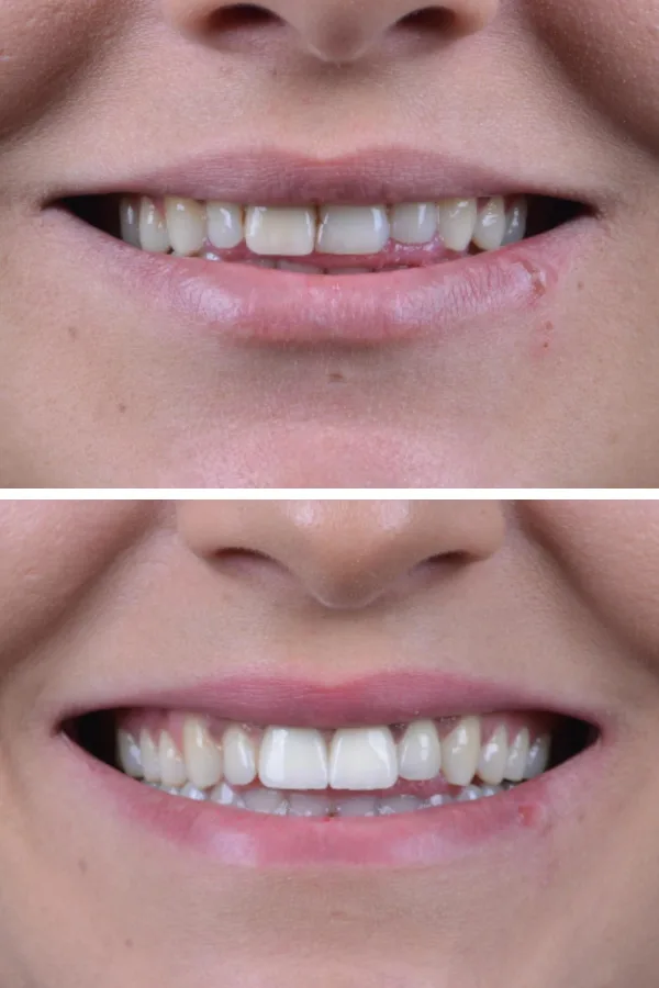 Palm Dental Clinic case