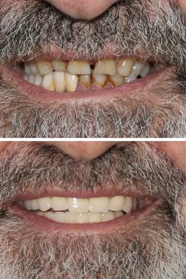 Palm Dental Clinic case