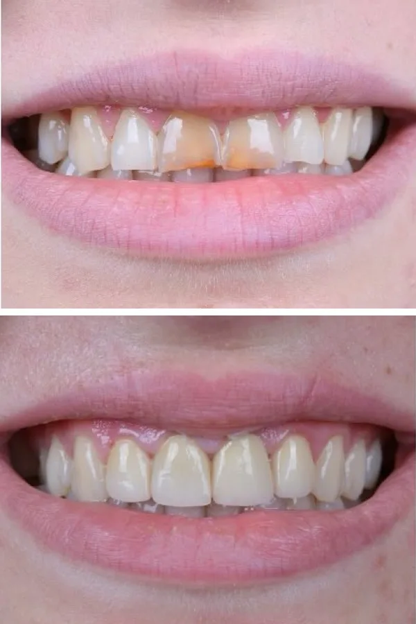 Palm Dental Clinic case