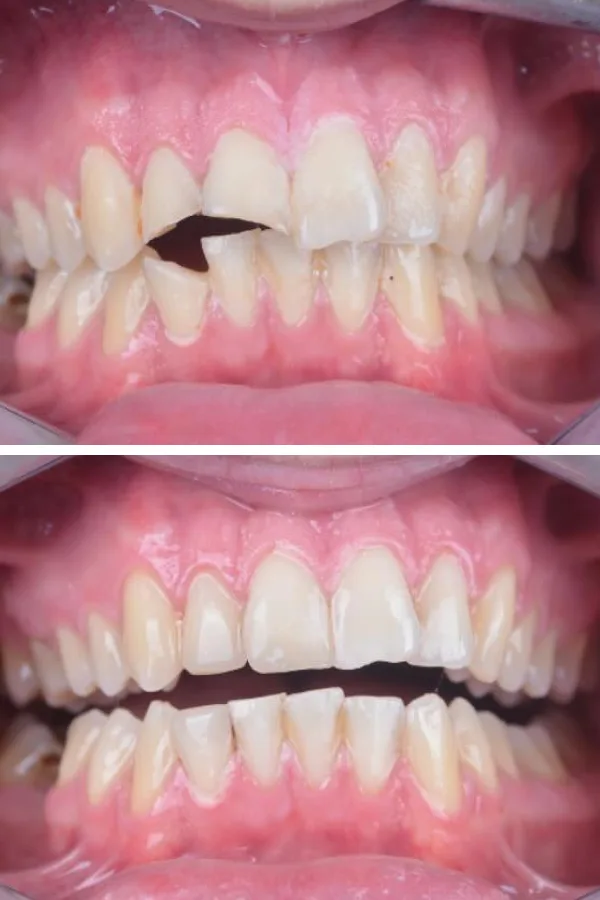 Palm Dental Clinic case