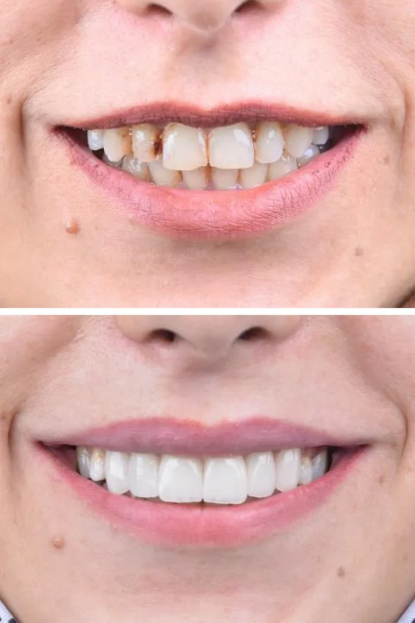 Palm Dental Clinic case