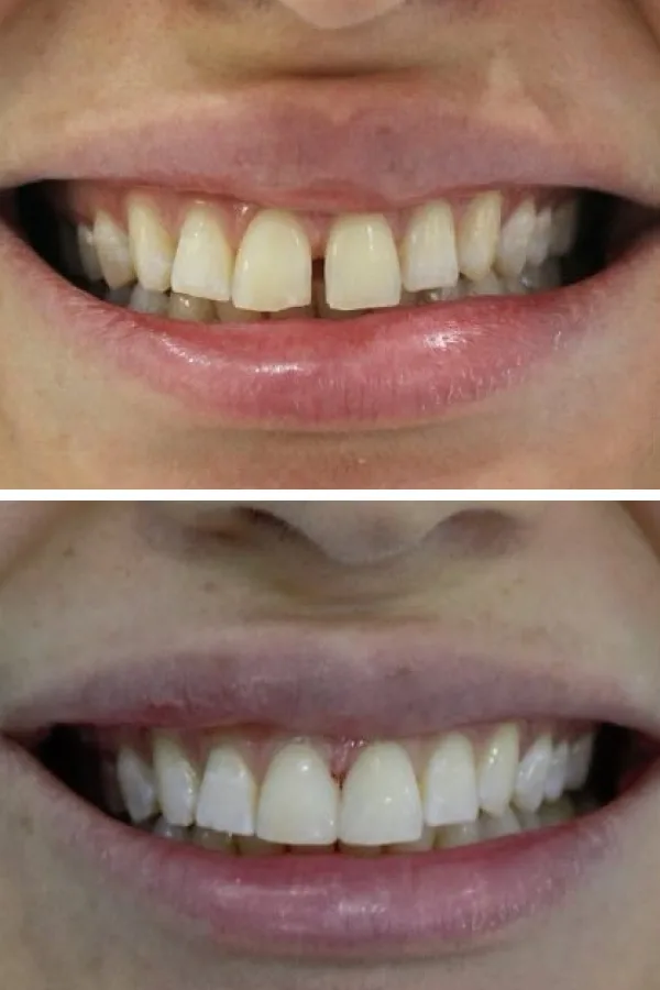 Palm Dental Clinic case