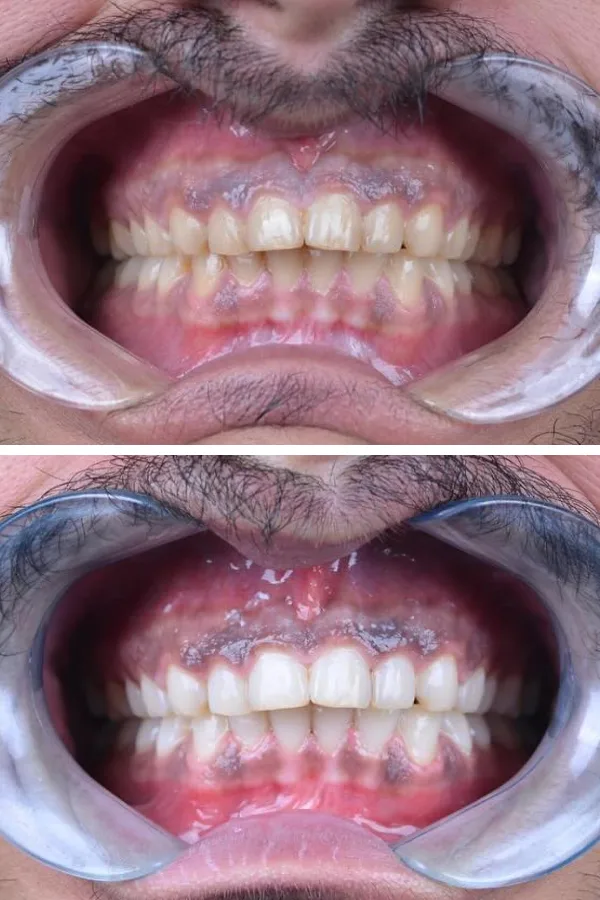 Palm Dental Clinic case