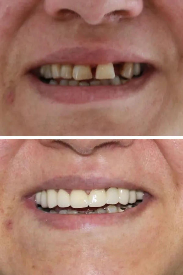 Palm Dental Clinic case