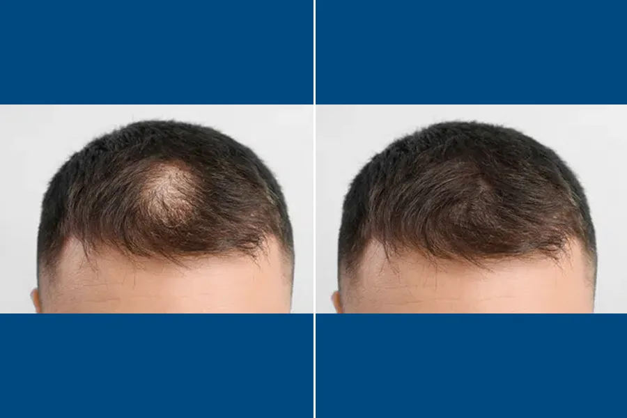 Regenera Activa: Revitalize Your Roots