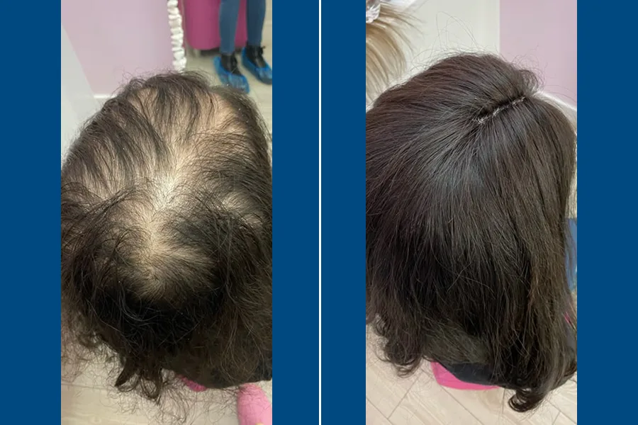 Regenera Activa: Revitalize Your Roots