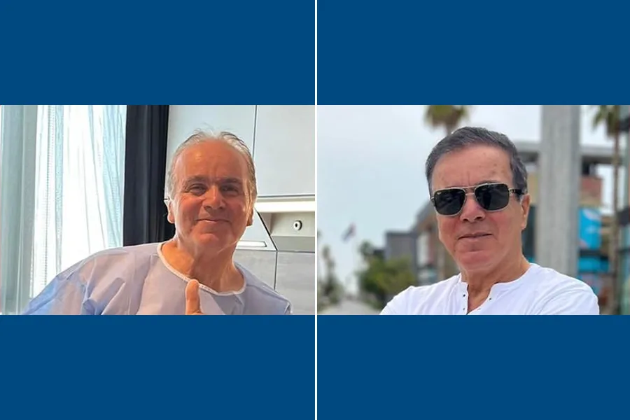 SDHI Hair Transplantation: Restore Fuller Hair