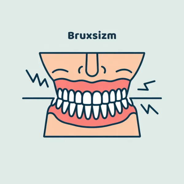 Teeth Grinding Treatment (Bruxism)