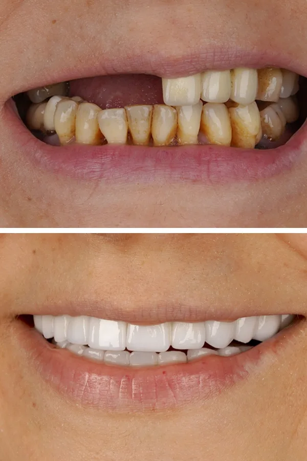 Turkeyana Clinic case