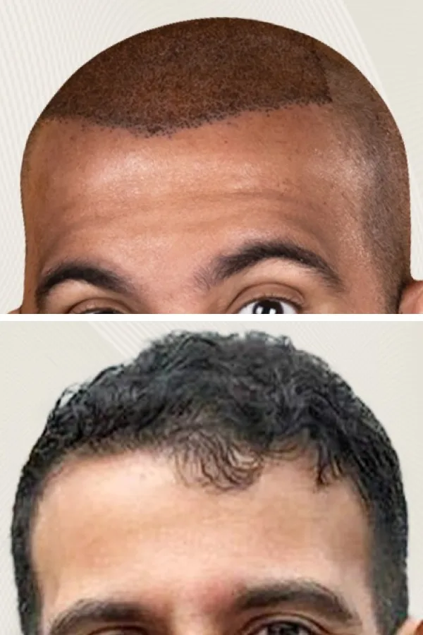 Turkeyana Clinic case