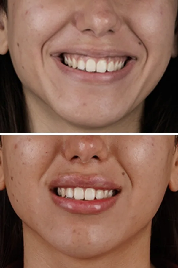 Turkeyana Clinic case