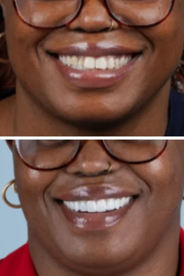 Turkeyana Clinic case