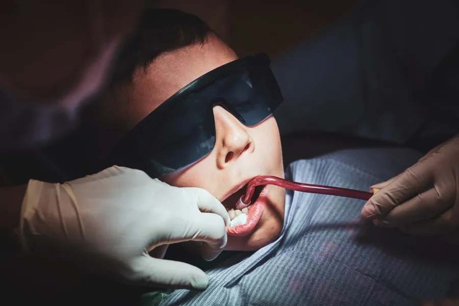 Wisdom Tooth Extraction