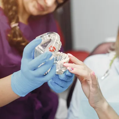 All-on-4 Dental Implants