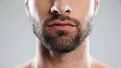 Beard Transplantation