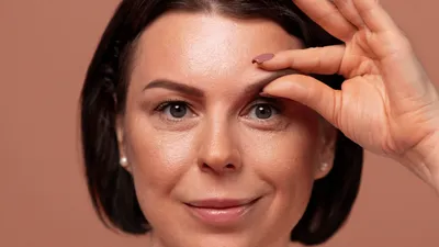 Blepharoplasty