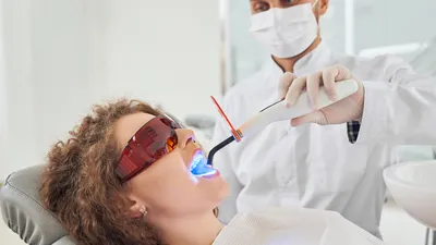 Composite Veneer