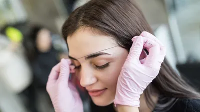 Eyebrow Transplantation