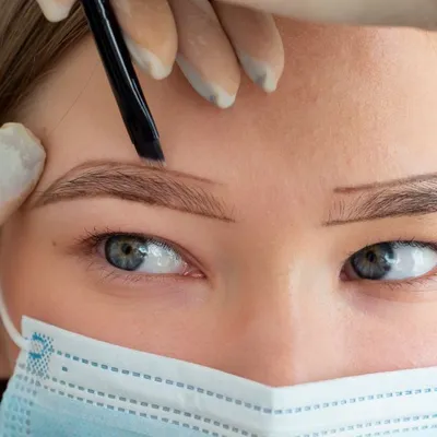 Eyebrow Transplantation