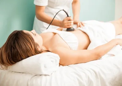 Laser Lipolysis