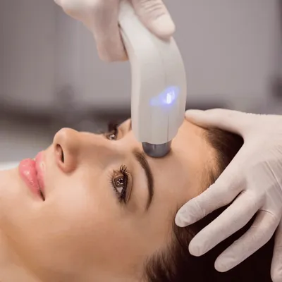 Laser Skin Resurfacing