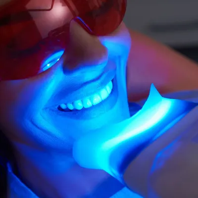 Professional Teeth Whitening