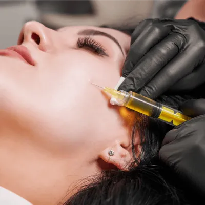 PRP Facial Rejuvenation